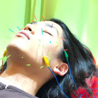 岡脇 美容鍼
